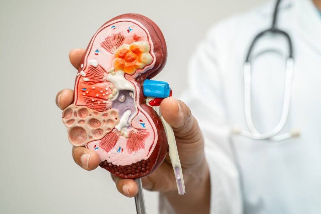 Casos de câncer de rim podem crescer quase 80% no Brasil até 2050